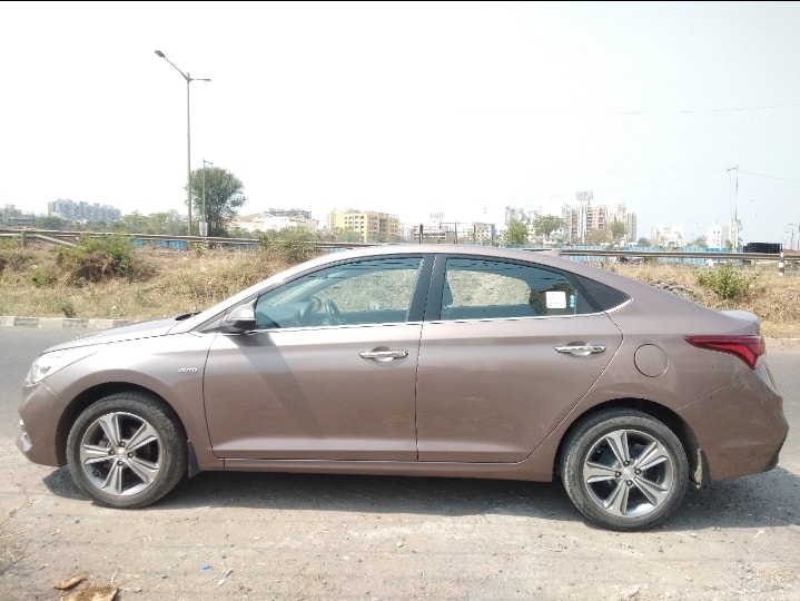 Verna image 9 Verna image 9