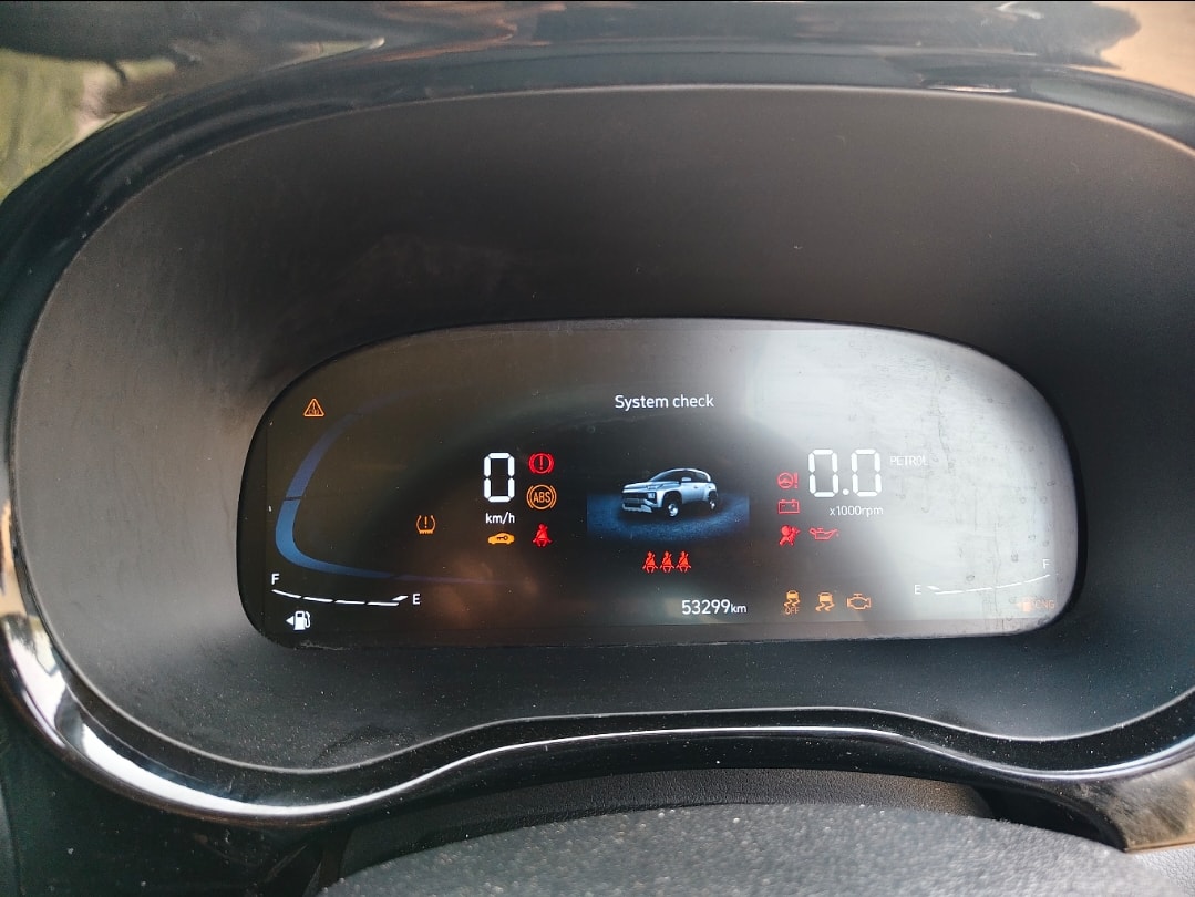 Exter image 11 Exter image 11