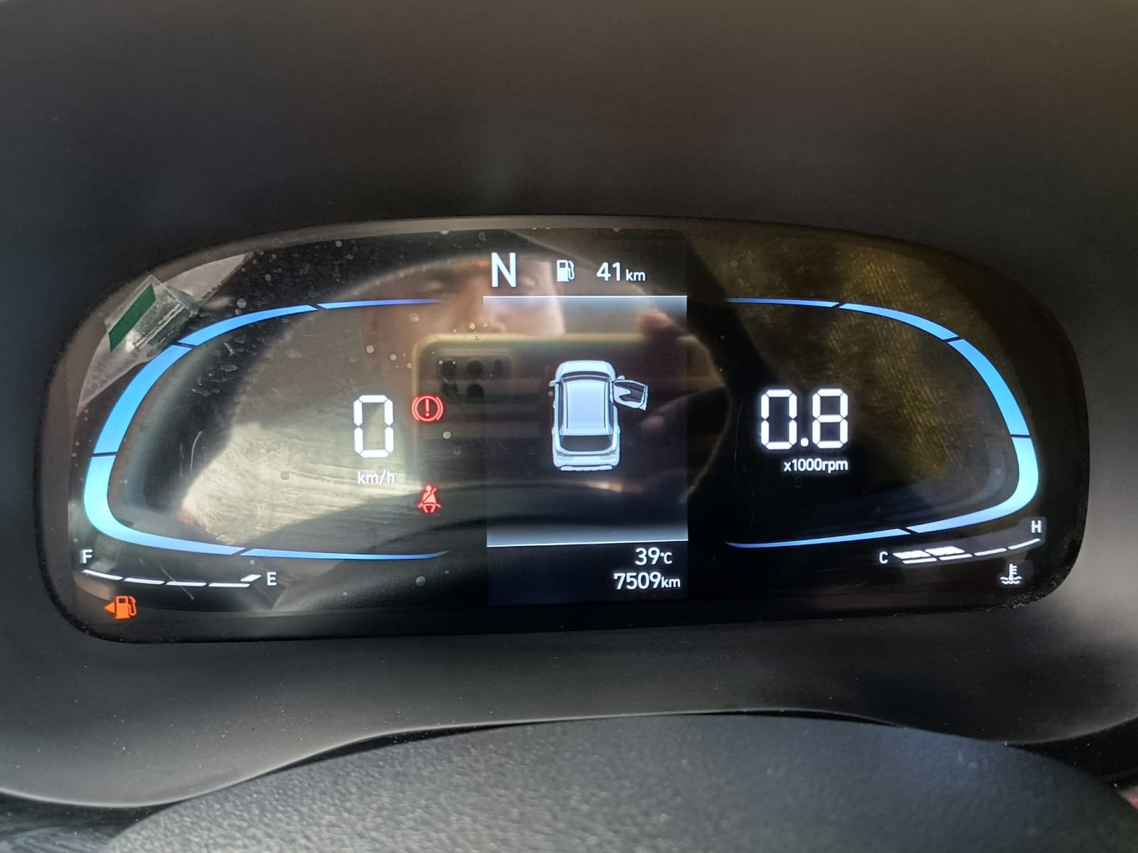 Exter image 11 Exter image 11